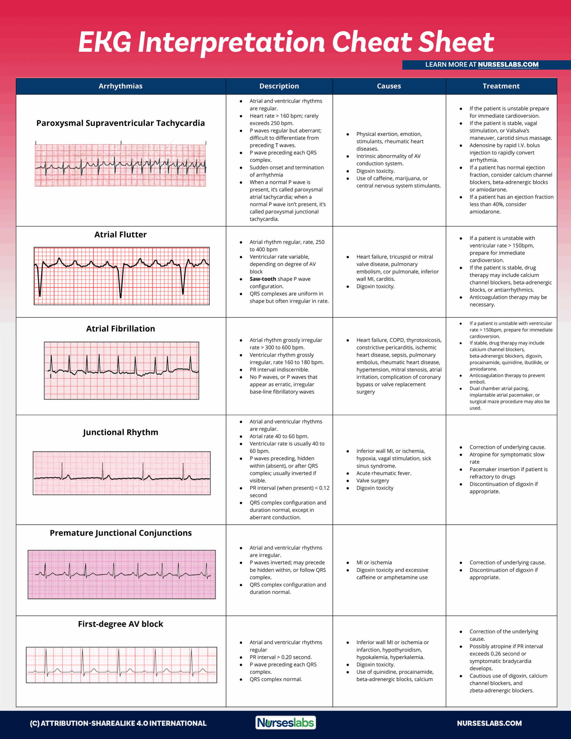 Free Printable Ekg Study Guide